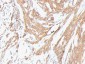  Actin, Muscle Specific (Muscle Cell Marker) Antibody - With BSA and Azide
